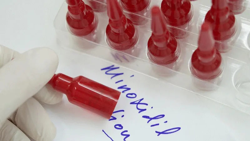 É necessário tomar Minoxidil após um transplante de cabelo?