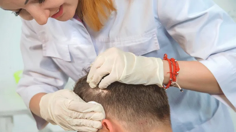 Turismo de saúde para transplante de cabello na Turquia
